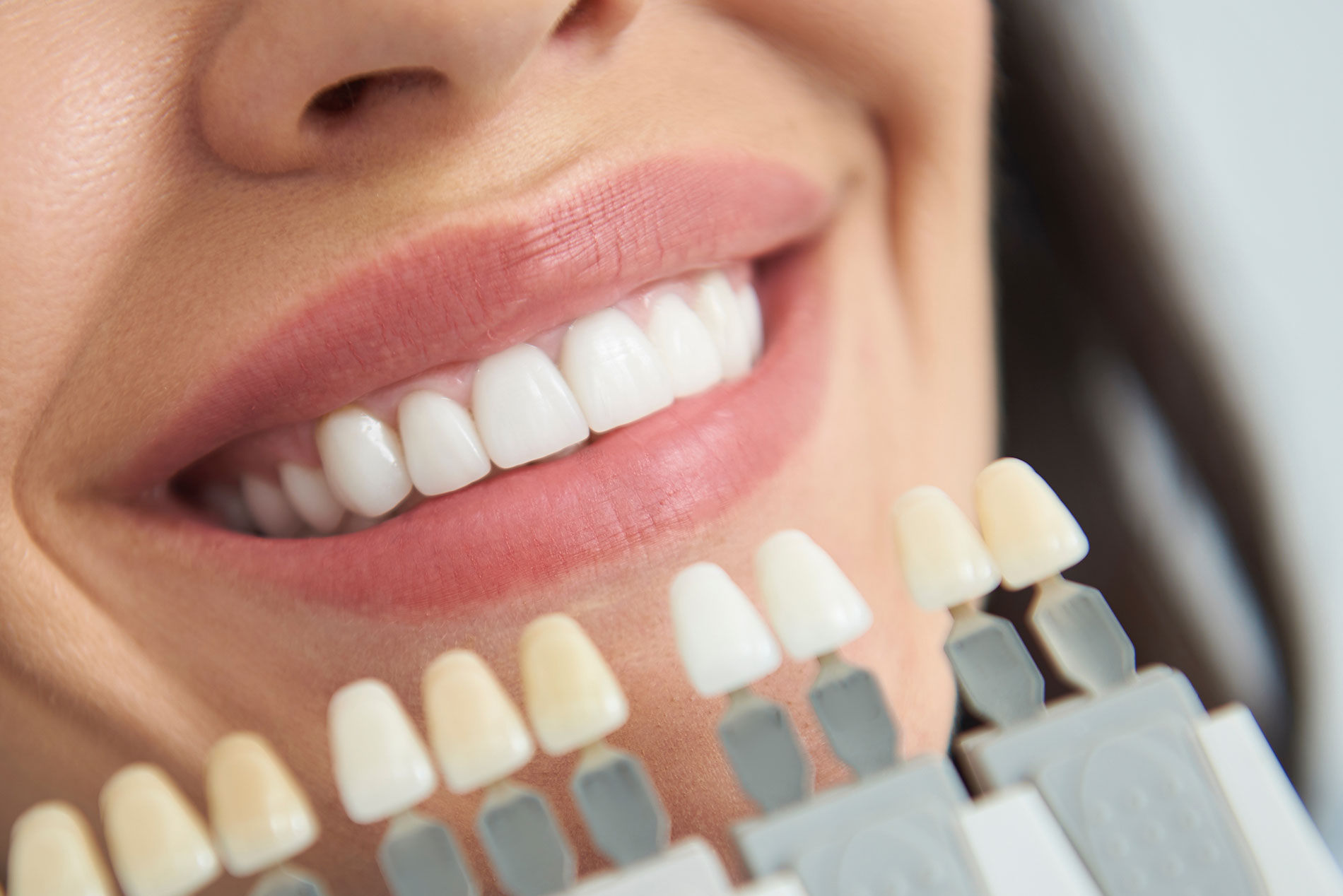 Cavity Treatment