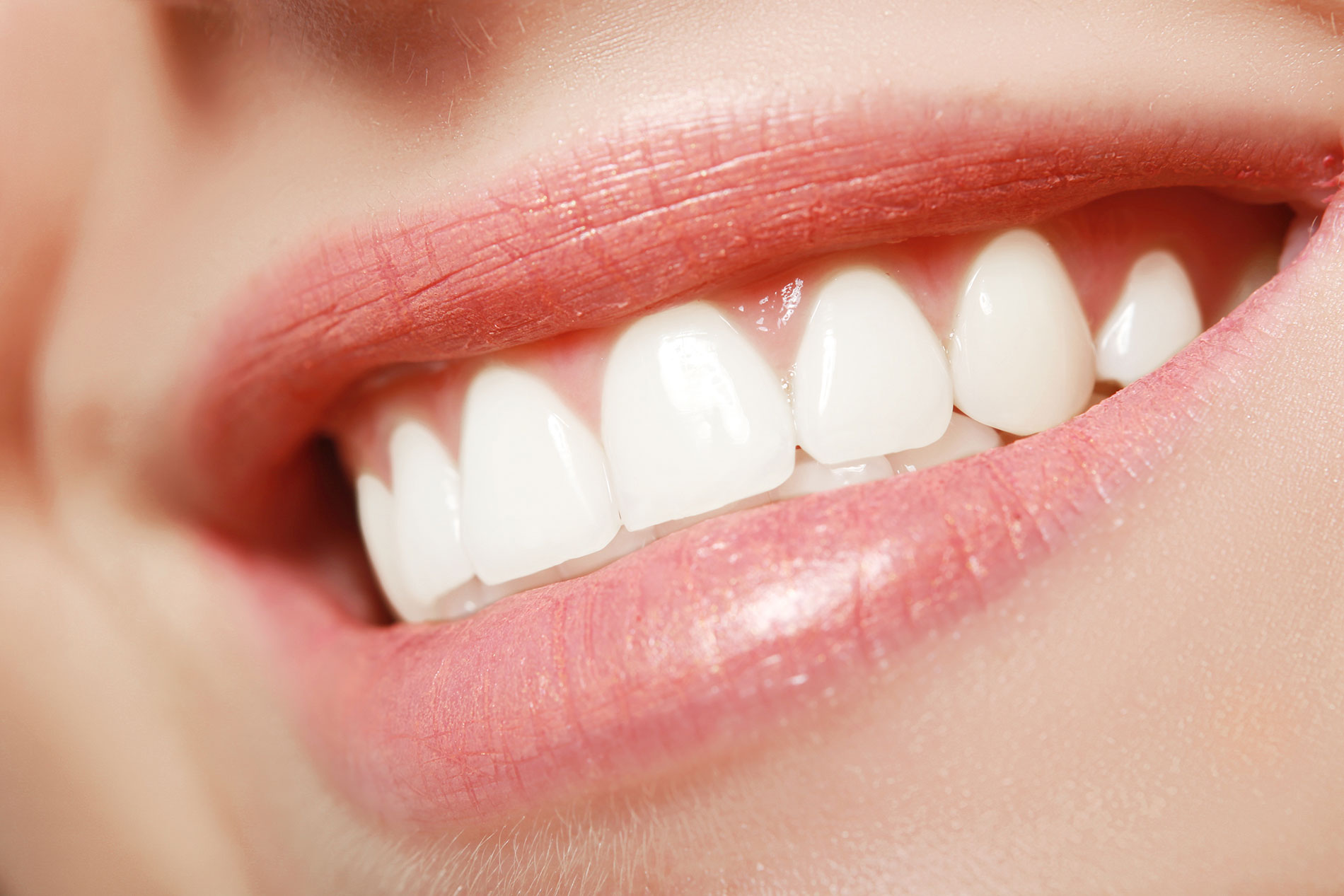 Tooth Fillings
