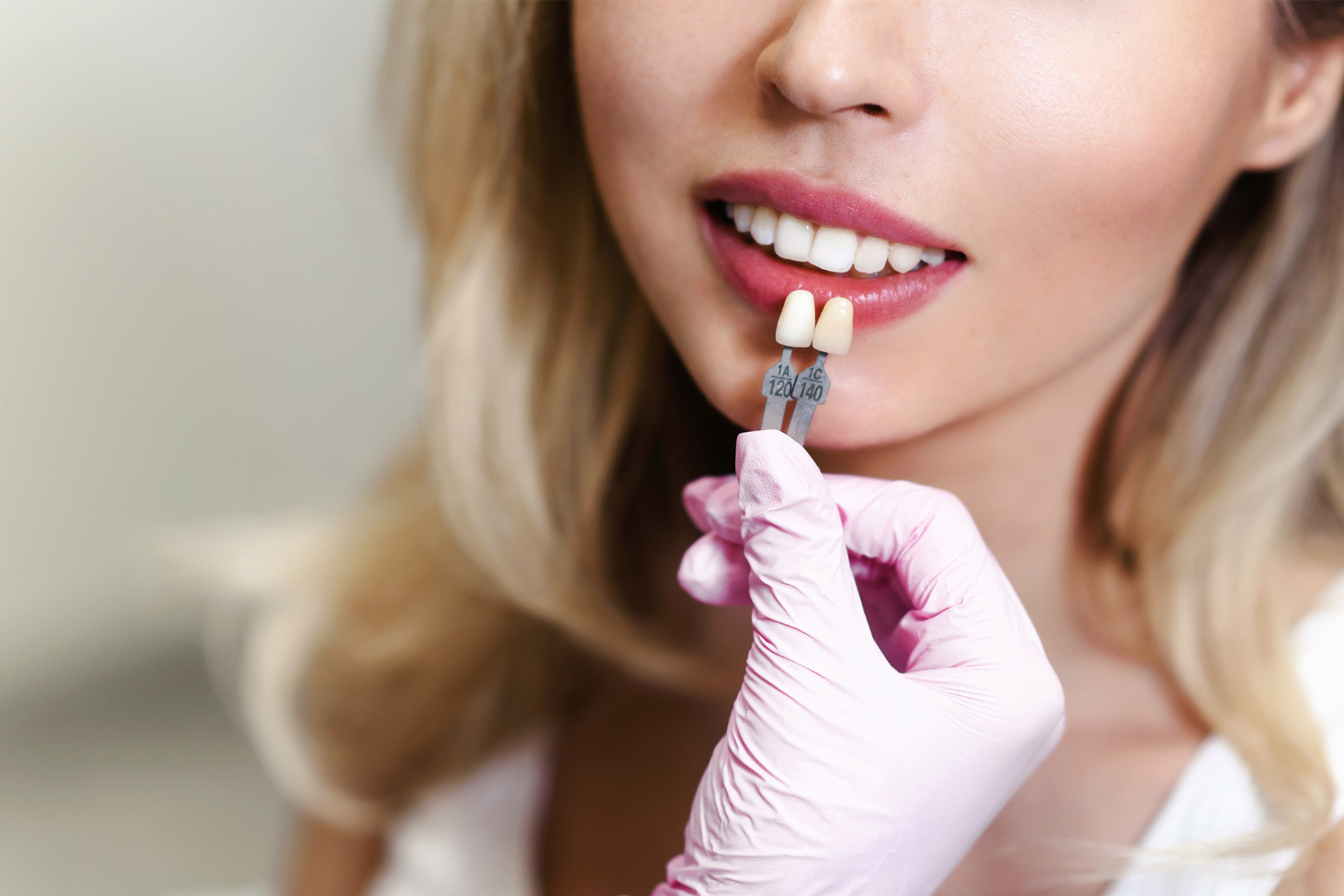 Tooth Fillings Los Angeles